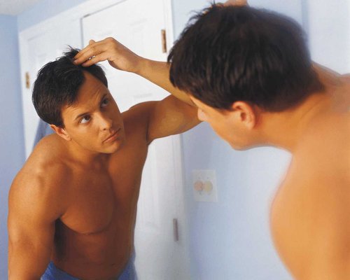 Caduta dei capelli: un vero cruccio soprattutto per gli uomini