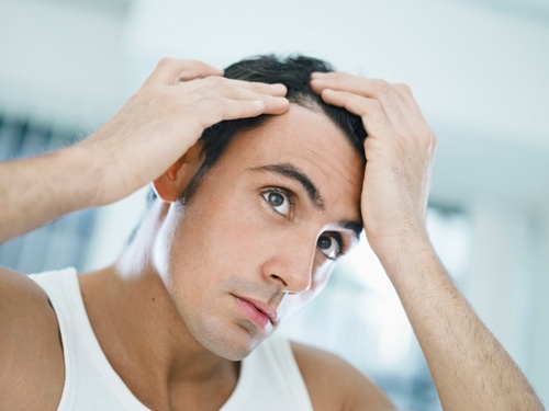 Trapianto di capelli: come rimediare chirurgicamente alla calvizie