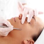 Dermaplaning contro la micropeluria del viso